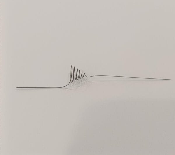 Shape setting Nitinol wire used in urological occluder device for medical applications